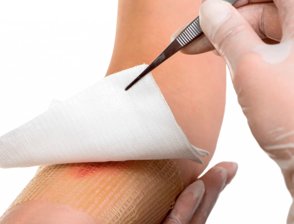 GAZE ESTERIL ALGODAO HIDROFILO CAIXA DE 100 UNIDADES